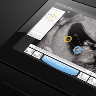 Portable ultrasound scanner in use